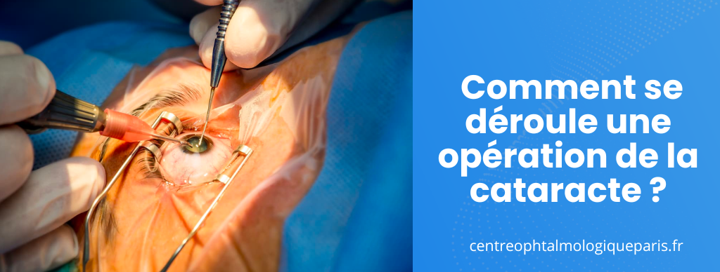 Comment se déroule une opération de la cataracte ?